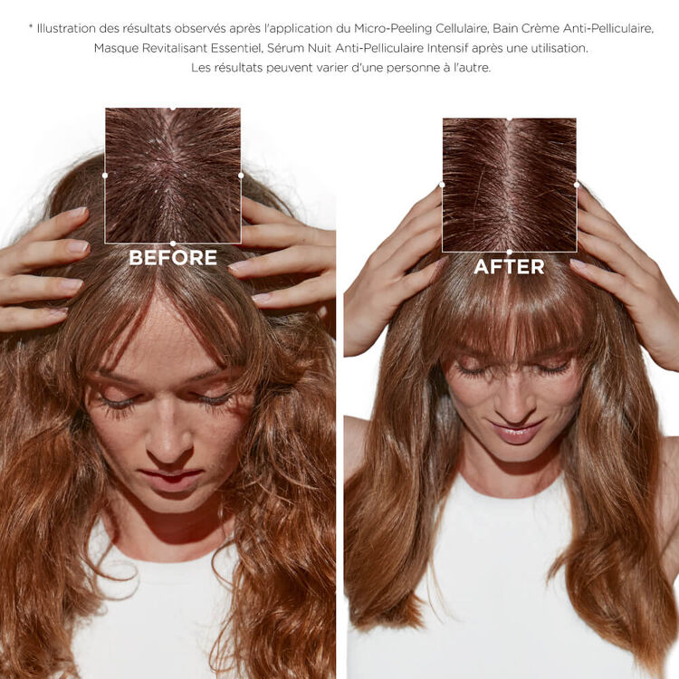 Trio Symbiose anti-pelliculaire cuir chevelu sec